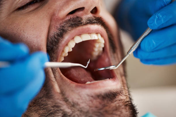 Best Broken or Cracked Tooth Emergency Dentist in Colmar Manor, MD